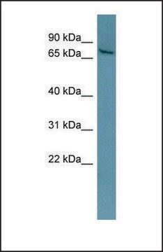 Anti-ESR1, (N-terminal) antibody produced in rabbit affinity isolated antibody