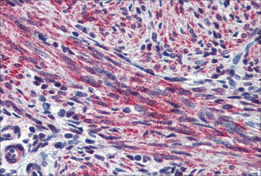 抗POSTN抗体 ウサギ宿主抗体 affinity isolated antibody