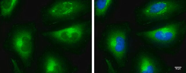 Monoclonal Anti-mTOR antibody produced in mouse clone GT6611, affinity isolated antibody