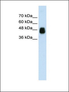 Anti-HOMER1 (AB2) antibody produced in rabbit affinity isolated antibody