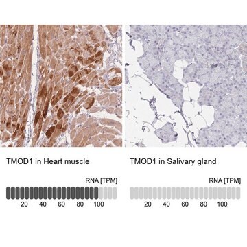 Anti-TMOD1 antibody produced in rabbit Prestige Antibodies&#174; Powered by Atlas Antibodies, affinity isolated antibody, buffered aqueous glycerol solution