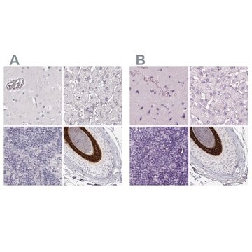 Anti-KRT25 antibody produced in rabbit Prestige Antibodies&#174; Powered by Atlas Antibodies, affinity isolated antibody, buffered aqueous glycerol solution