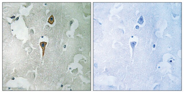 抗-NMDAR1 兔抗 affinity isolated antibody