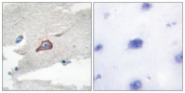 Anti-HCK antibody produced in rabbit affinity isolated antibody