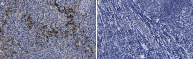 Anti-IL-17A Antibody, clone 6F9.2.12.1.5