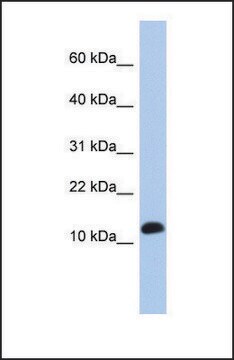 Anti-RPL30 antibody produced in rabbit affinity isolated antibody