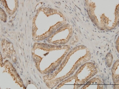 Monoclonal Anti-K-ALPHA-1 antibody produced in mouse clone 4D1, purified immunoglobulin, buffered aqueous solution