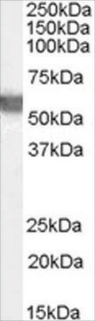 抗G6PD(アミノ酸308-320)抗体 ヤギ宿主抗体 affinity isolated antibody, buffered aqueous solution