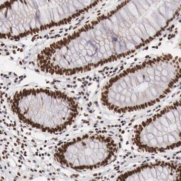 Anti-PHF14 antibody produced in rabbit Prestige Antibodies&#174; Powered by Atlas Antibodies, affinity isolated antibody, buffered aqueous glycerol solution