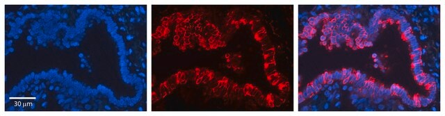 抗KRT7 ウサギ宿主抗体 affinity isolated antibody