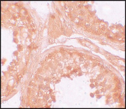 Anti-NOD6 antibody produced in rabbit affinity isolated antibody, buffered aqueous solution