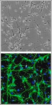 Neurony przodomózgowia szczura: RHbN