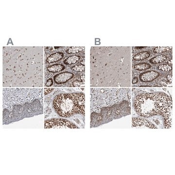 Anti-CHD1L antibody produced in rabbit Prestige Antibodies&#174; Powered by Atlas Antibodies, affinity isolated antibody, buffered aqueous glycerol solution