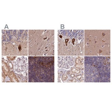 Anti-SPRYD3 antibody produced in rabbit Prestige Antibodies&#174; Powered by Atlas Antibodies, affinity isolated antibody, buffered aqueous glycerol solution