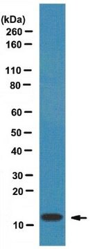 Anti-FSP1/S100A4 Antibody from rabbit