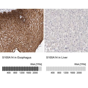 Anti-S100A14 antibody produced in rabbit Prestige Antibodies&#174; Powered by Atlas Antibodies, affinity isolated antibody, buffered aqueous glycerol solution