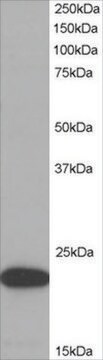 Anti-ASC/TMS1 antibody produced in goat affinity isolated antibody, buffered aqueous solution