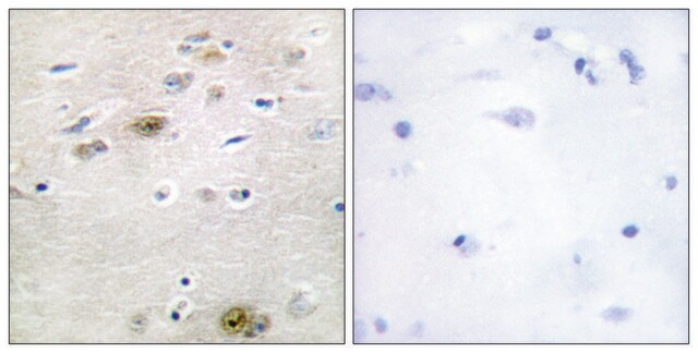 Anti-TRA-2 &#945; antibody produced in rabbit affinity isolated antibody