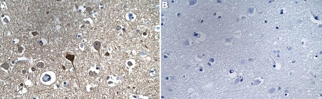 Anti-DYNC1I1 Antibody, clone 1F11 ZooMAb&#174; Rabbit Monoclonal recombinant, expressed in HEK 293 cells