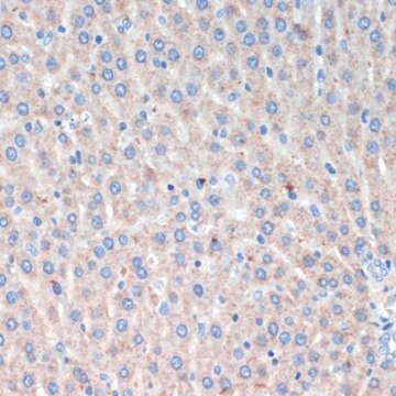 Anti-LRRK2 antibody produced in rabbit