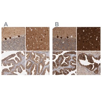 Anti-BAIAP2 antibody produced in rabbit Prestige Antibodies&#174; Powered by Atlas Antibodies, affinity isolated antibody, buffered aqueous glycerol solution