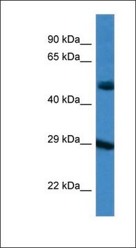 Anti-GJD3 antibody produced in rabbit affinity isolated antibody