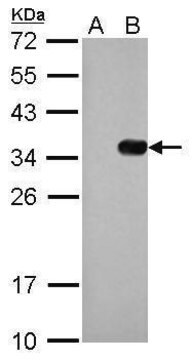 Monoklonalnyznacznik anty-S clone GT247, affinity isolated antibody