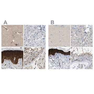 Anti-SERPINB5 antibody produced in rabbit Prestige Antibodies&#174; Powered by Atlas Antibodies, affinity isolated antibody, buffered aqueous glycerol solution