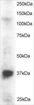 Anti-PINX1 antibody produced in goat affinity isolated antibody, buffered aqueous solution