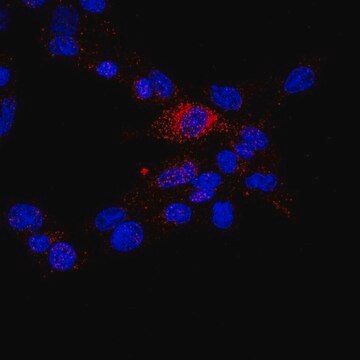 Anti-TIMP-3-Antikörper, C-Terminus from rabbit, purified by affinity chromatography