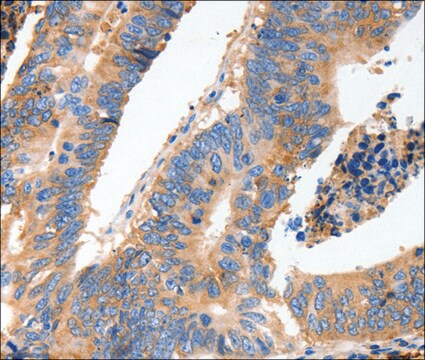 Anty-MUC6 affinity isolated antibody