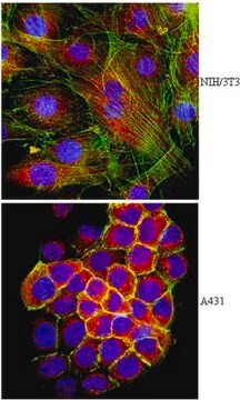 Anti-F-actin-capping protein subunit beta Antibody from rabbit