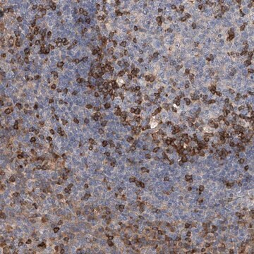 Anti-IPCEF1 antibody produced in rabbit Prestige Antibodies&#174; Powered by Atlas Antibodies, affinity isolated antibody, buffered aqueous glycerol solution