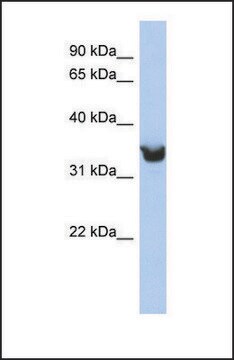 Anti-DLK1 antibody produced in rabbit affinity isolated antibody