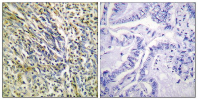 抗-蛋白聚糖（裂解-Asp369），N-端 兔抗 affinity isolated antibody