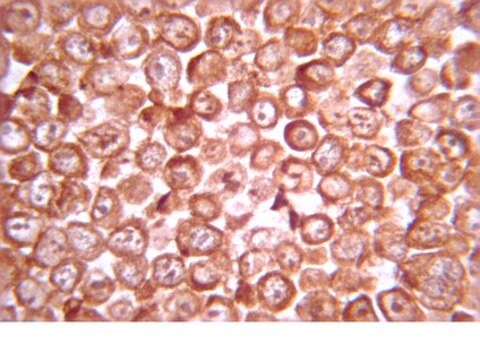 Przeciwciało anty-GSK-3b, n.a. 335-349 from rabbit, purified by affinity chromatography