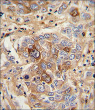 ANTI-CD163 (N-TERM) antibody produced in rabbit IgG fraction of antiserum, buffered aqueous solution