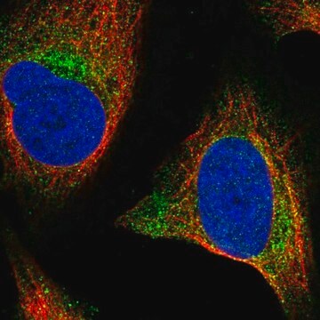 抗WNT2B抗体 ウサギ宿主抗体 Prestige Antibodies&#174; Powered by Atlas Antibodies, affinity isolated antibody