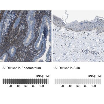 抗ALDH1A2 ウサギ宿主抗体 Prestige Antibodies&#174; Powered by Atlas Antibodies, affinity isolated antibody, buffered aqueous glycerol solution