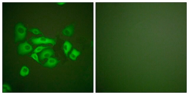 Anti-Keratin 10 antibody produced in rabbit affinity isolated antibody