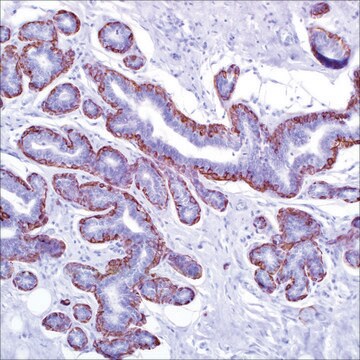 Calponin (CALP) Mouse Monoclonal Antibody