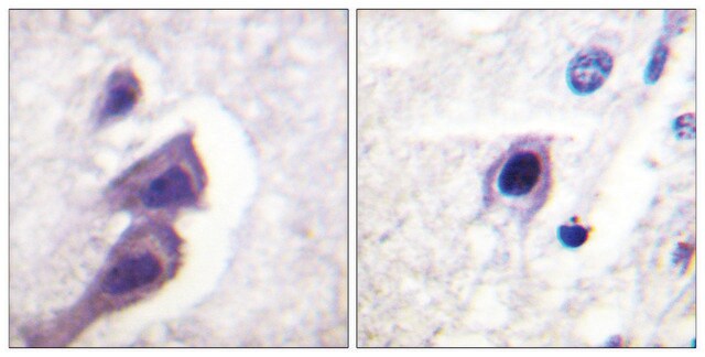 Anti-TSC2, C-Terminal antibody produced in rabbit affinity isolated antibody