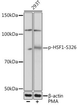 Anti-Phospho-HSF1-S326