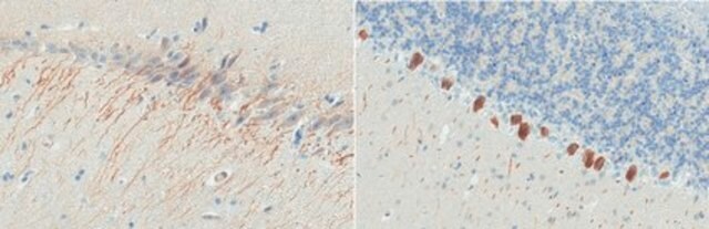 Anti-LC3C from rabbit, purified by affinity chromatography