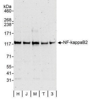 Rabbit anti-NF-kappaB2 Antibody, Affinity Purified Powered by Bethyl Laboratories, Inc.