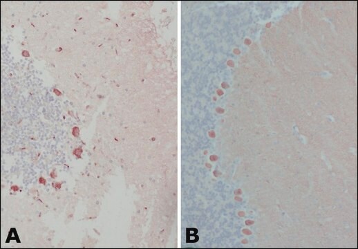 抗 钙结合蛋白-D-28K (EG-20) 兔抗 affinity isolated antibody, buffered aqueous solution