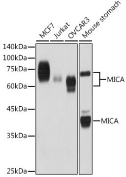 Anti-MICA Antibody, clone 5A1P3, Rabbit Monoclonal