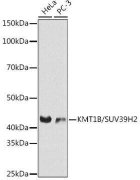 Anti-KMT1B / SUV39H2 Antibody, clone 6L2D9, Rabbit Monoclonal