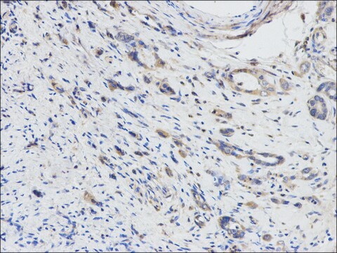 Anti-DPYD antibody produced in rabbit affinity isolated antibody