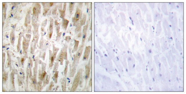 Anti-LIMK2 antibody produced in rabbit affinity isolated antibody